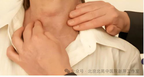 甲状腺结节怎样有效消除赵萍专家想要结节好,趁早做好这3点
