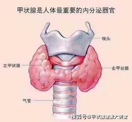 桥本氏甲状腺炎到底能不能治好这些事情你应该了解一下