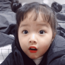 一场手术过后,义乌一大伯的脚趾长在了手指上