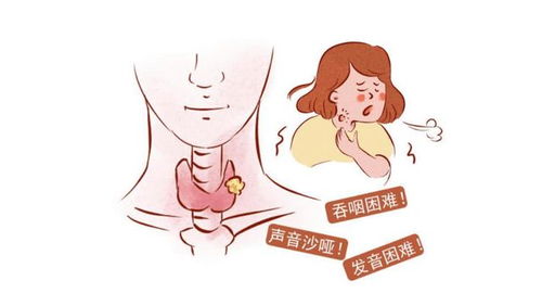 要想甲状腺结节变好,记住这四要四不要
