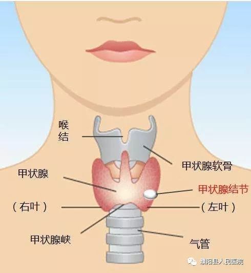 甲状腺结节的护理